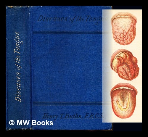 Item #237728 Diseases of the tongue / by Henry T. Butlin. Henry Trentham Sir Butlin.