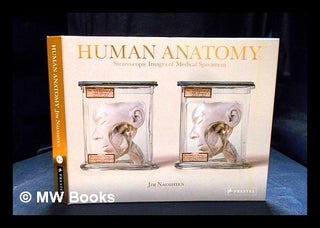 Item #402386 Human anatomy : stereoscopic images of medical specimens : from the collection of...